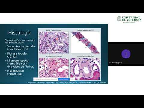 Ciclosporina y Tacrolimus en Trasplante Renal - Dra. Lina Marcela Aguirre