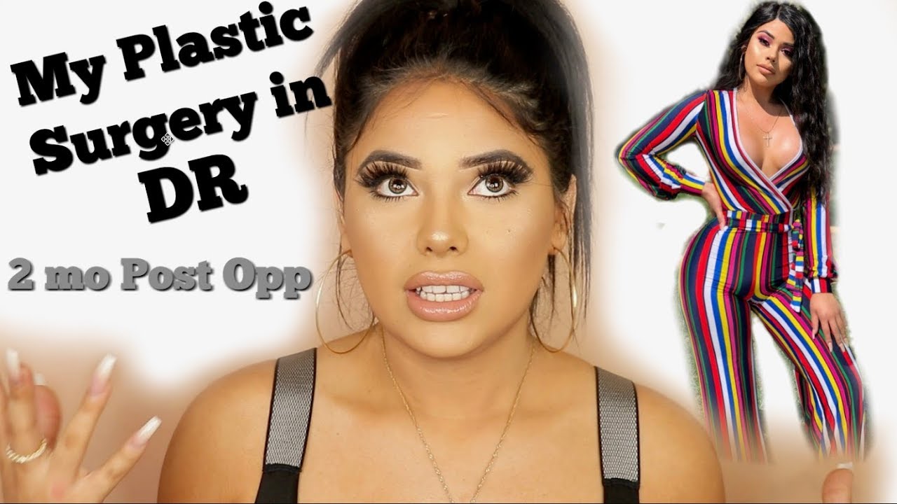 My Plastic Surgery in DR - Post Op Update