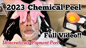 Chemical Peel Full Application |Skinceuticals Pigment Peel | How I Got Rid Of Hyperpigmentation 2023