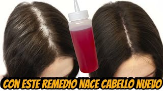 NO LO USES MUCHO!! NACE CABELLO HASTA DONDE NO TIENES😱DEJA DE CAERSE Y CRECE RAPIDO😍 screenshot 1