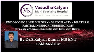 FESS WITH MICRODEBRIDER+SEPTOPLASTY+B/L PARTIAL INFERIOR TURBINATE REDUCTION -Dr. S. KalyanKumar MS