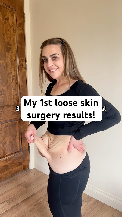 Patience was essential throughout my weight loss journey... and now it's building my recovery. 💜