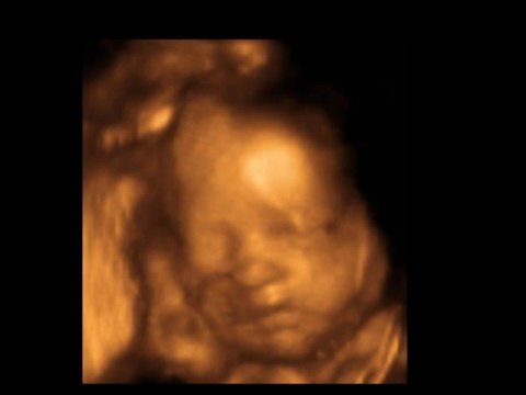 30 Weeks Baby 3D 4D Ultrasound - My Sunshine Baby Ultrasounds