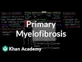 Understanding Primary Myelofibrosis
