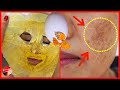 With Peel Off Egg - Turmeric Mask, She Removed Spots , Black Heads and Whitened Her Face