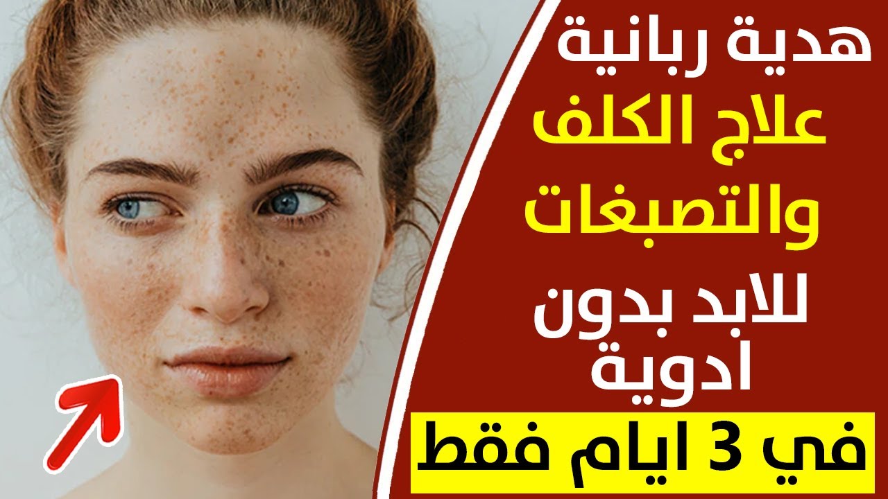 هبة من الله لمن تعاني مشاكل البشرة و علاج الكلف وصفةطبيعية فعالة علاج جفاف البشرة علاج حب الشباب