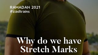 لماذا تتكون التشققات الجلدية (stretch marks)