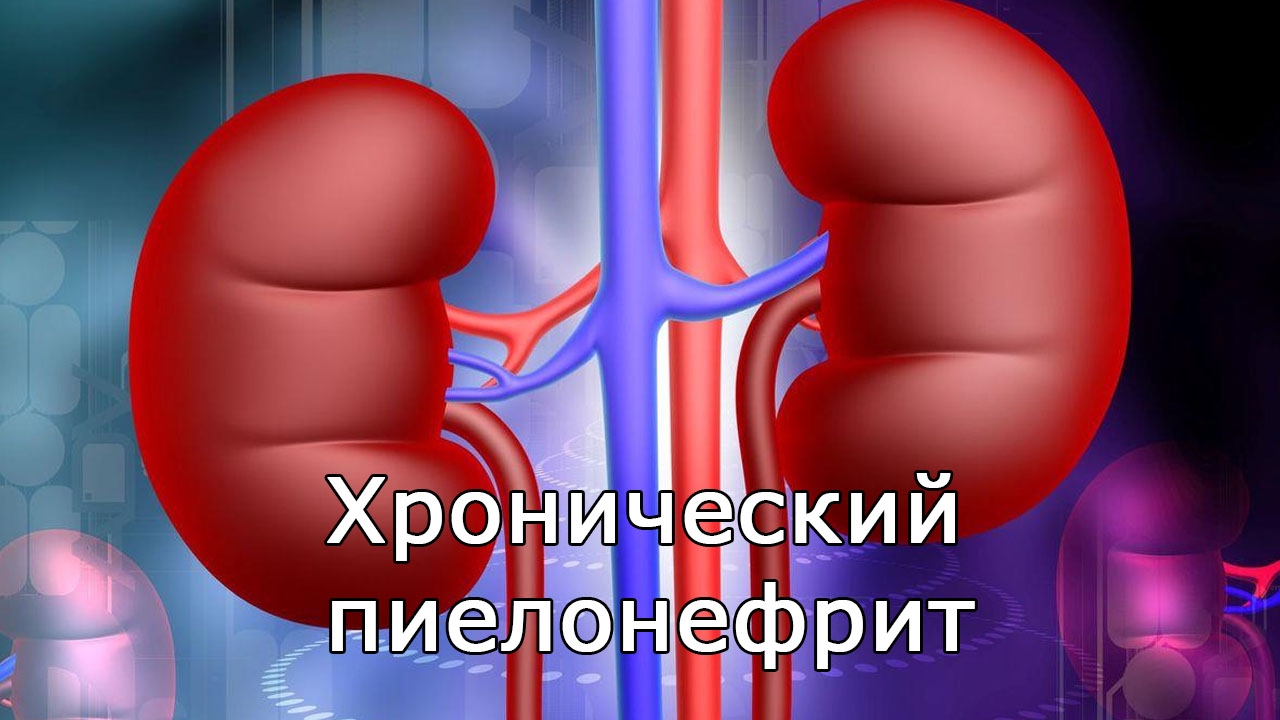 Хронический пиелонефрит