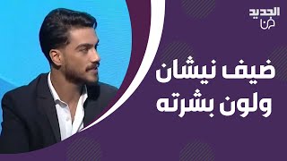 ضيف نيشان يروي معاناته مع رفاقه في المدرسة بسبب لون بشرته : كرهت حالي !! ما حصل معه غير متوقع