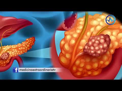 Video: Saratani Ya Pancreatic (Insulinoma) Katika Mbwa