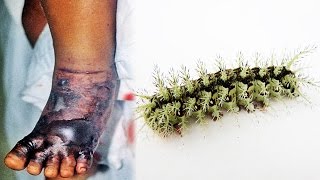 top 10 most poisonous bugs in the world