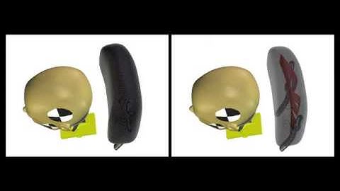 Finray Kopfstütze HS KL