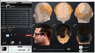 HARRTS Hair Studio | Hair Transplant Result Simulation Tool screenshot 5