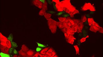 [JuLI Stage Application Video]Cell growth images for 72 hours Cell Proliferation