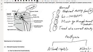 ARRHYTHMIA Part 1 : USMLE Step 2 , 3 - MCCQE1