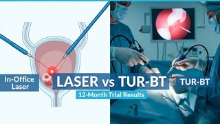 137:Ta Bladder Tumors: In-Office Laser Coagulation Compared to TUR-BT