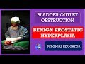 Benign prostatic hyperplasia how to diagnose  treat  bladder outlet obstruction