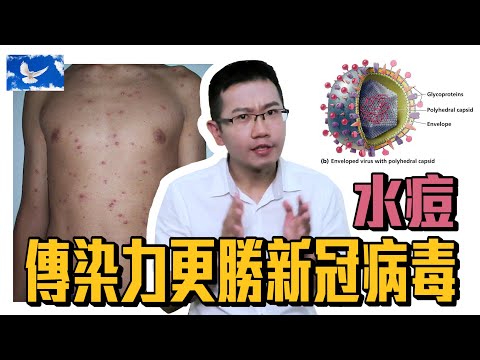 【水痘/皮蛇】傳染力勝過新冠肺炎好幾倍的病毒!? 水痘與帶狀皰疹 | 蒼藍鴿聊醫學EP136