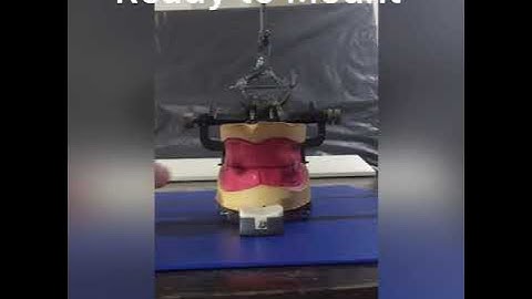 Mounting of Casts on an Average Value Articulator