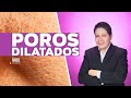 POROS DILATADOS || DR MARINO DERMATOLOGO
