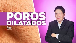 POROS DILATADOS || DR MARINO DERMATOLOGO