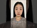 Korean Plastic Surgery Review Rhinoplasty Facial Contouring Double Eyelid Surgery Nosejobs Korean Plastic Surgery Review Rhinoplasty Facial Contouring Double Eyelid Surgery Nosejobs