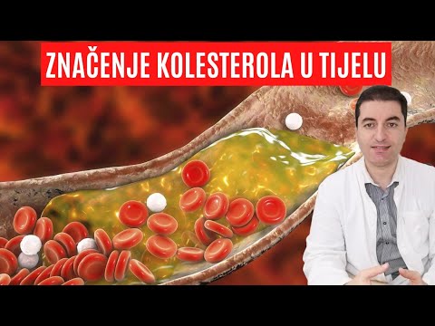 Video: Zašto je povišen kolesterol u krvi kod žena?