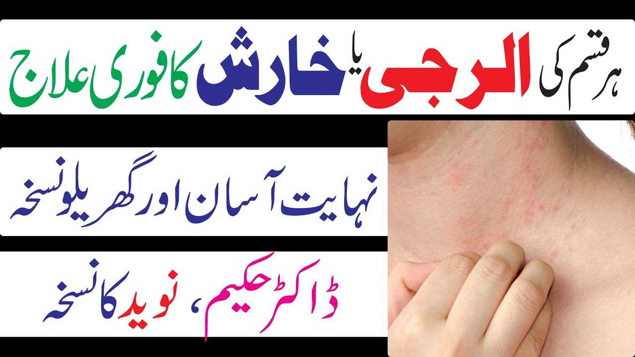 Alerji ka Ilaj/Skin rash treatment home remedies/alerji ka Desi gharelu