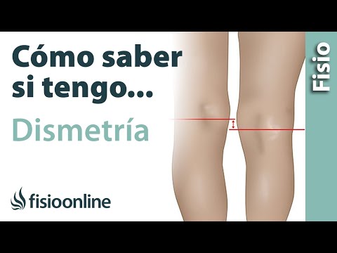 Video: Cómo saber si una pierna es más corta (con imágenes)