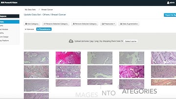 Classify breast cancer with IBM PowerAI Vision