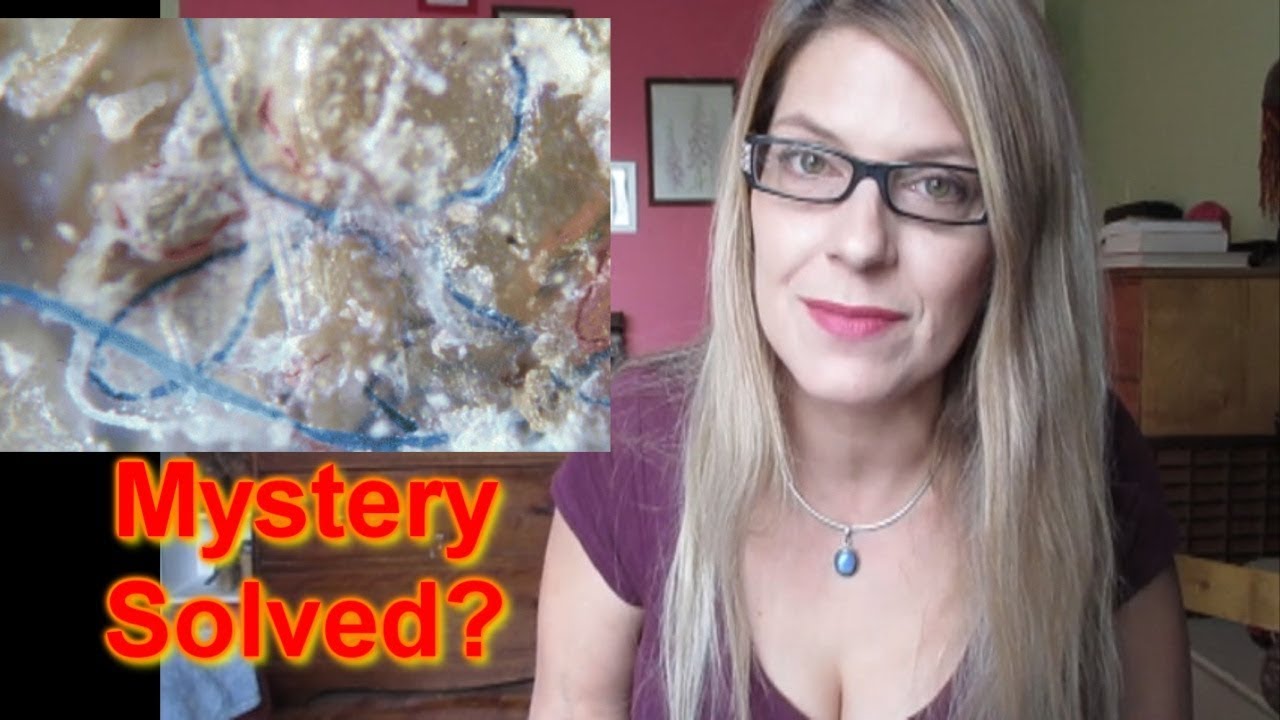 Morgellons Hastalığı Morgellons Hastalığı