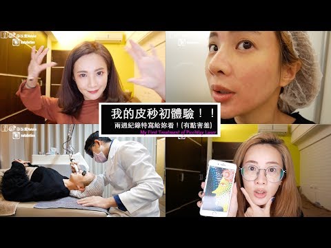 皮秒初體驗！！皮秒是在幹麻？兩週全紀錄特寫給妳看！▸▸My First Treatment of PicoWay Laser