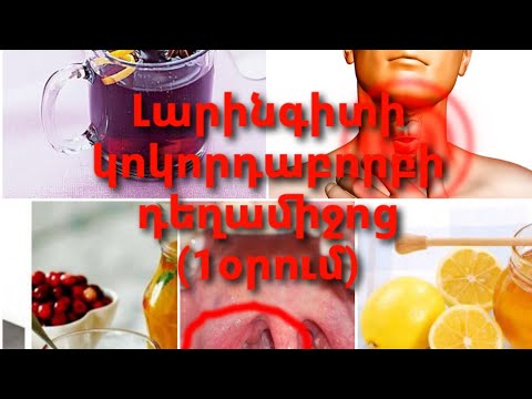 Video: Ինչպես բուժել լարինգիտը. 10 քայլ (նկարներով)