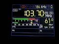 [Tropo] 103,7 - Радио 333, Melitopol (115 km)  27 July 2023