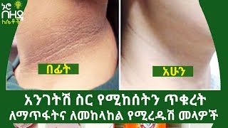 Ethiopia: አንገትሽ ስር የሚከሰትን ጥቁረት ለማጥፋትና ለመከላከል የሚረዱሽ መላዎች | Nuro Bezede