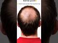 “Super Fast Hair Growth Remedy at Home 🏡. #beauty #hairgrowth #hairgrowth #trending #viral