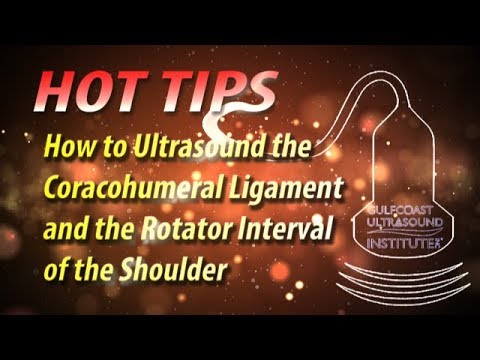 Video: Ketepatan Infiltrasi Ligamen Coracohumeral Yang Dibimbing Oleh Ultrasound Dan Ultrasound - Siri Kes Cadaveric Kemungkinan