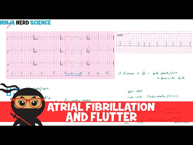 Understanding AFib: How to measure your own heart rate and rhythm