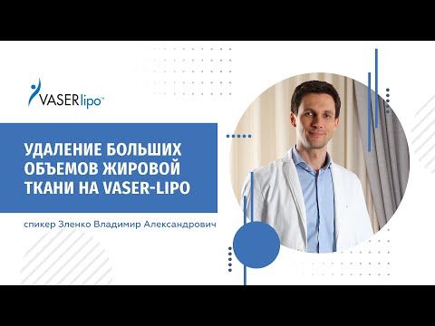 Удаление больших объемов жировой ткани на VASER-lipo