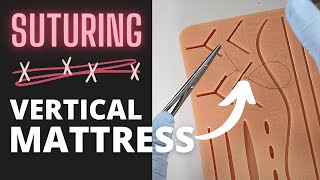 Mastering The Vertical Mattress Suture | OnlineExodontia.com