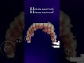 Inside RR Dental Labs  How India’s Top Digital Dental Lab Delivers Precision Every Day