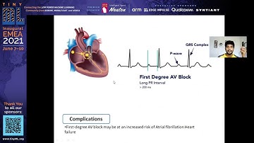 EMEA 2021 tiny Talks: ECG Analyzer