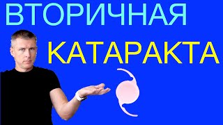 видео: Вторичная катаракта: лечение лазером. Как избавиться от вторичной катаракты. картинка: Вторичная катаракта: лечение лазером. Как избавиться от вторичной катаракты.