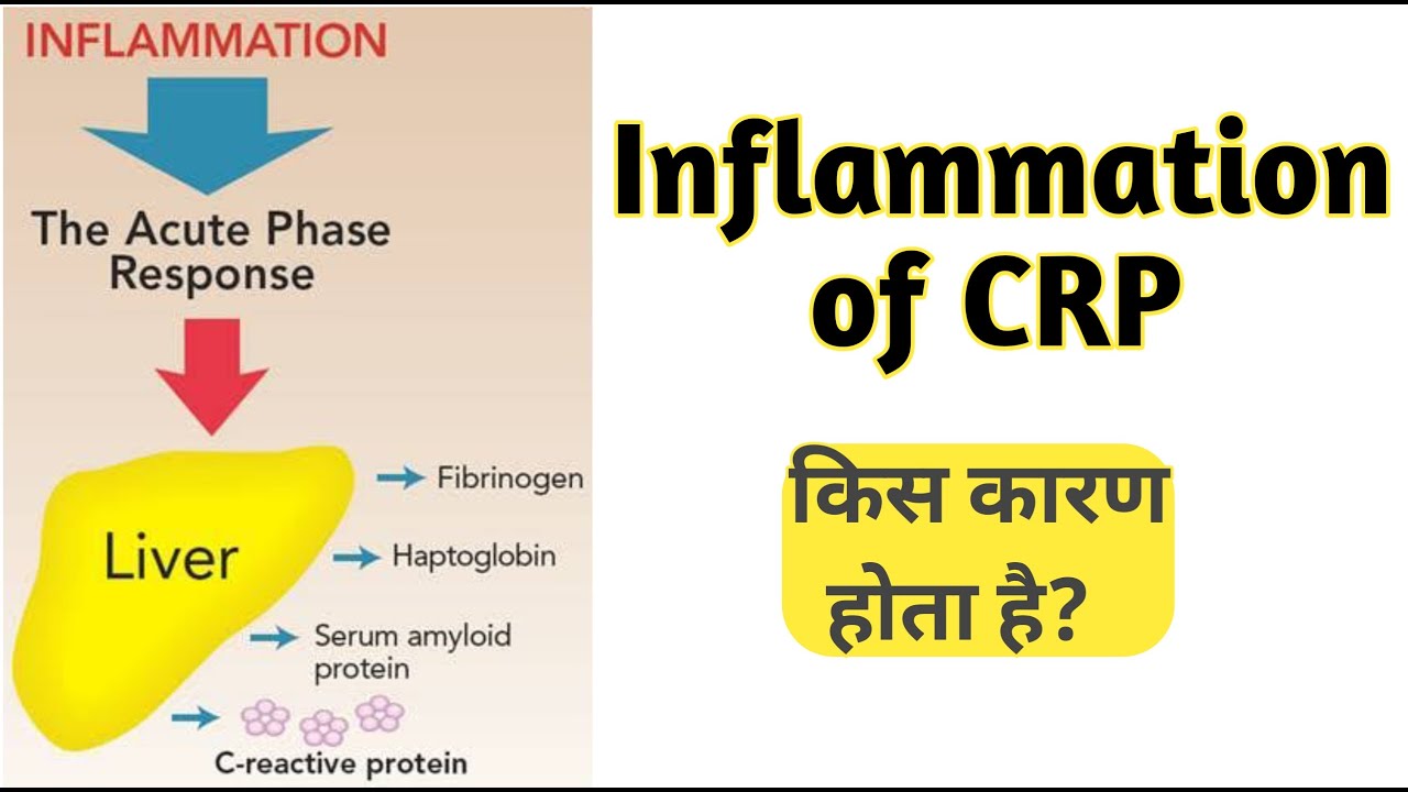 Inflammation in hindi what is inflammation Inflammation YouTube