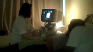 The 3d 4d Ultrasound Experience at Goldenview Ultrasound Chicago, Boston, New York \& San Antonio