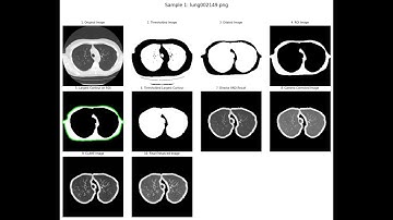 Automated Lung ROI Extraction from CT Scans using OpenCV + Contours + Gamma Correction