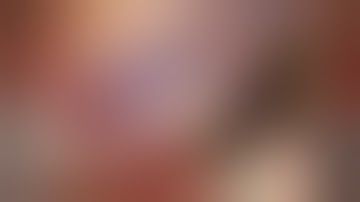 I Glide Preloaded DSAEK