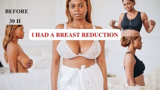 I G0T A BREAST REDUCTION/LIFT - MY RESULTS