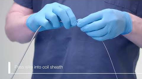 Emergency Lithotripsy with the VorticCatchV Basket