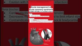 Acute management of acute coronary syndrome (STEMI, NSTEMI, or unstable angina) Acute management of acute coronary syndrome (STEMI, NSTEMI, or unstable angina)